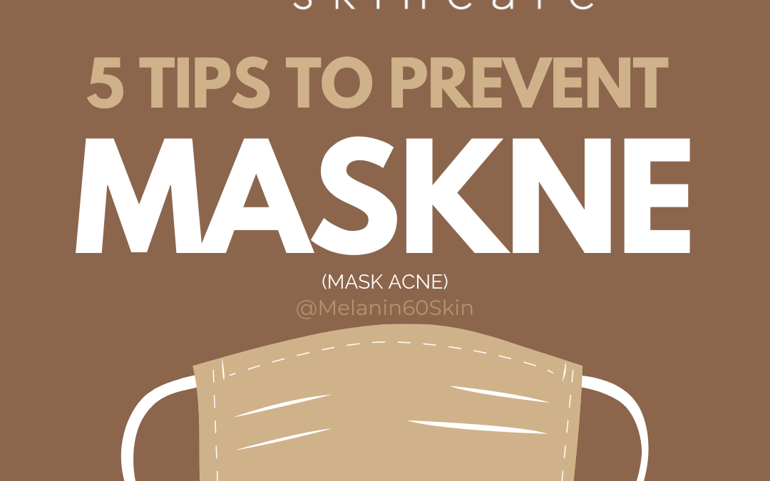 5 Tips to Prevent Maskne